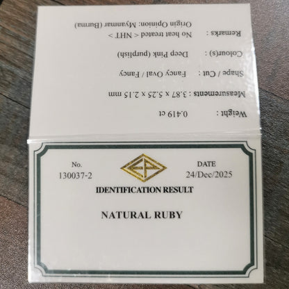 Un-Heat Ruby 0.419ct / Burma