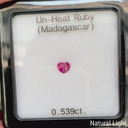 Un-Heat Ruby 0.539ct / Madagascar